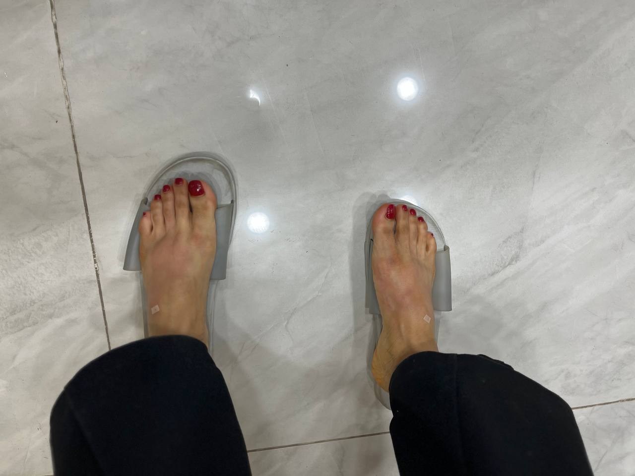 تزریق چربی