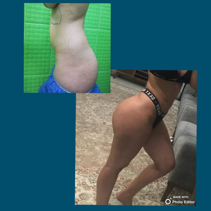 پیکر تراشی ۳۶۰درجه