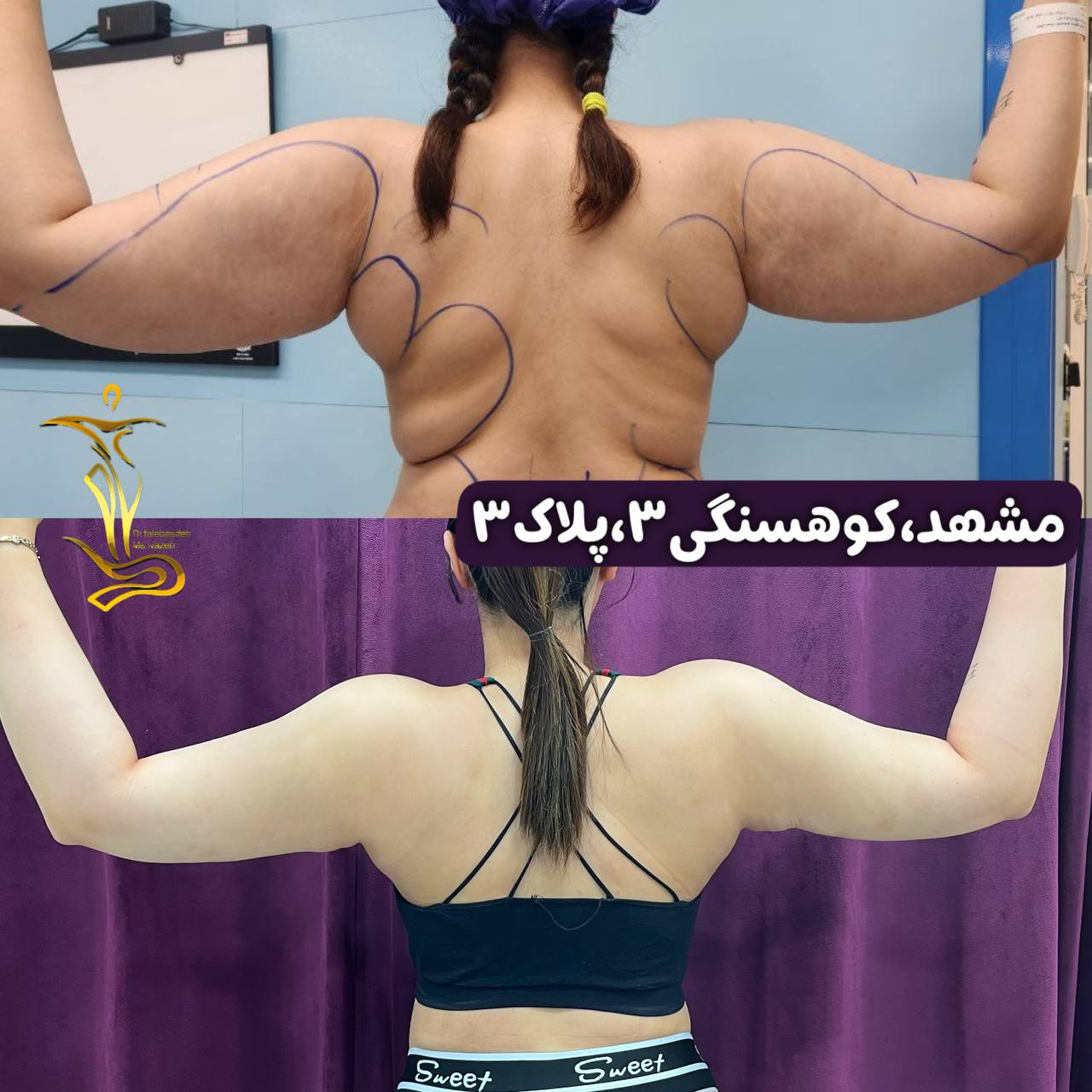 پیکر تراشی ۳۶۰درجه