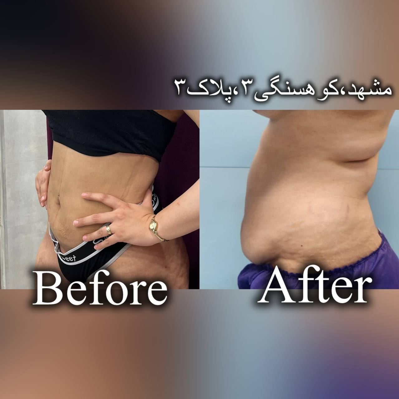 پیکر تراشی ۳۶۰درجه