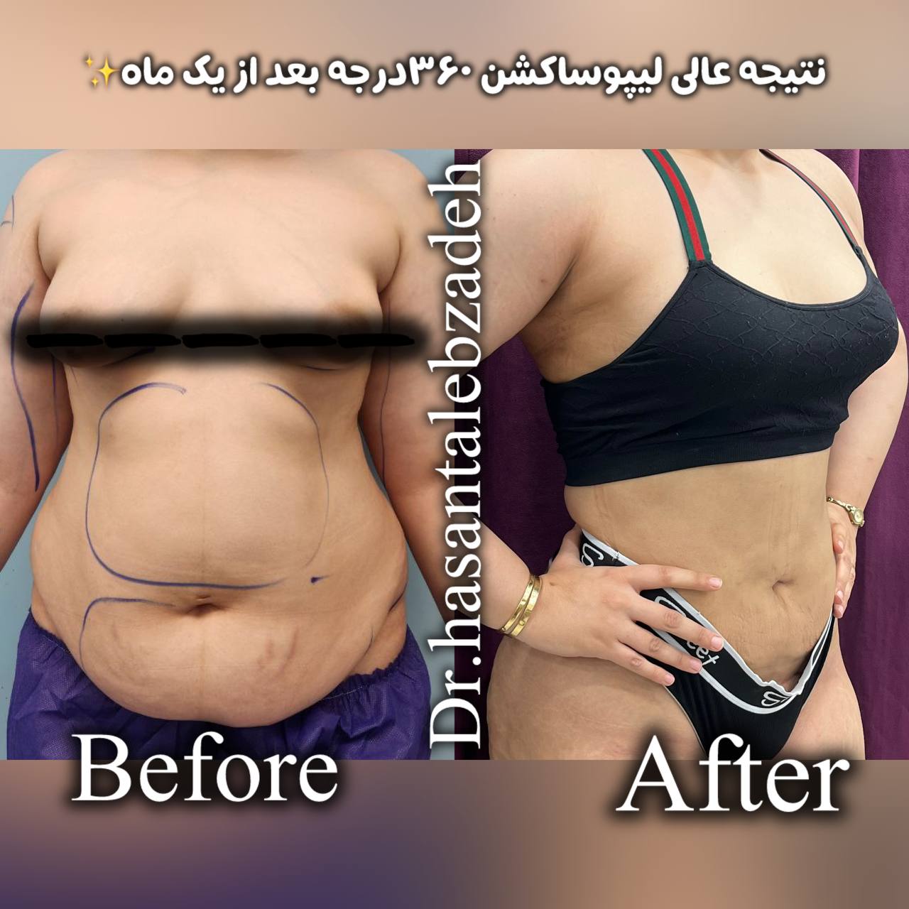 پیکر تراشی ۳۶۰درجه