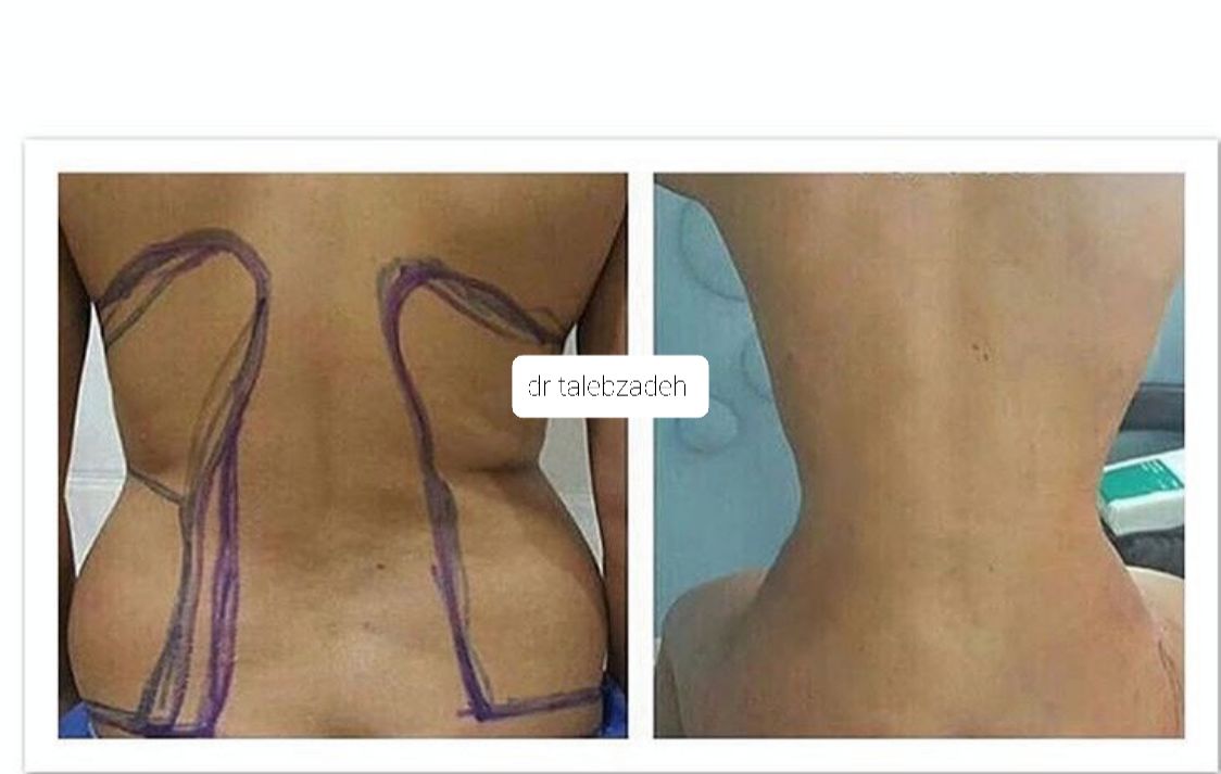 پیکر تراشی ۳۶۰درجه