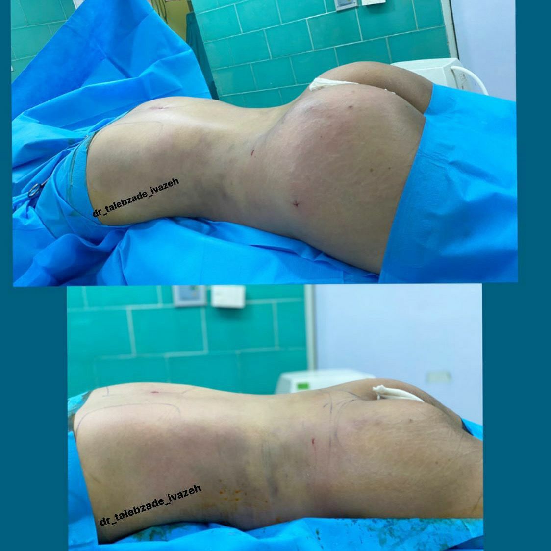 پیکر تراشی ۳۶۰درجه