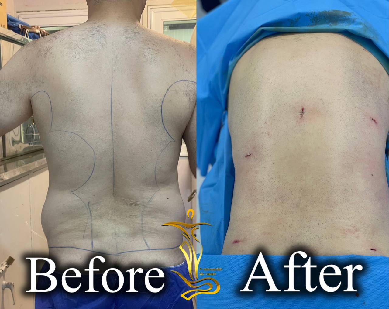 پیکر تراشی ۳۶۰درجه