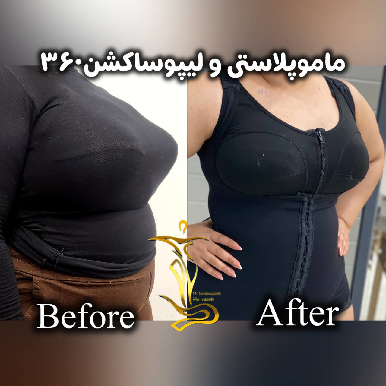 پیکر تراشی ۳۶۰درجه