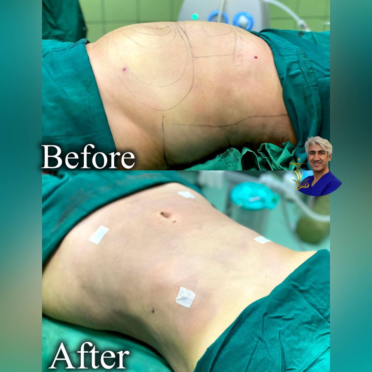 پیکر تراشی ۳۶۰درجه