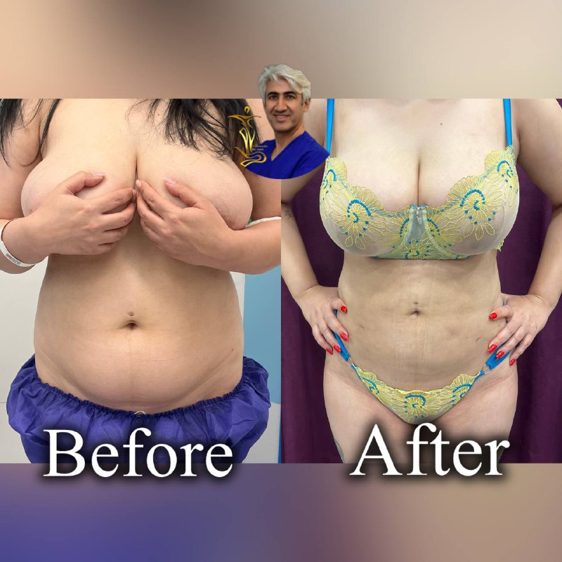 پیکر تراشی ۳۶۰درجه
