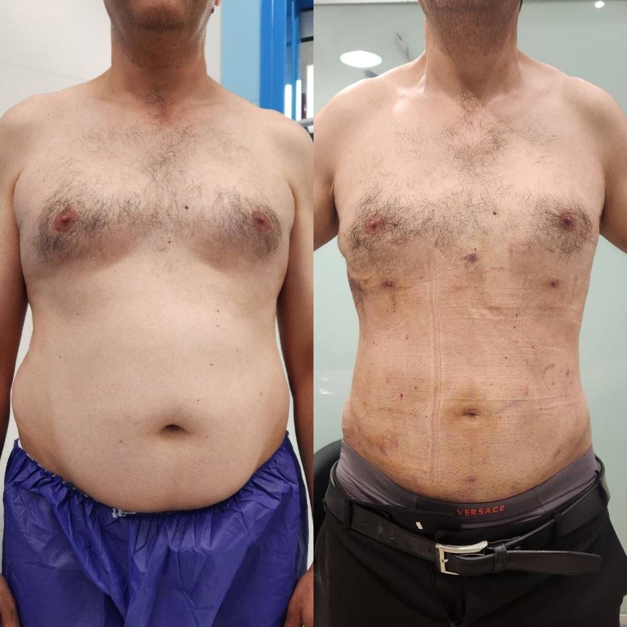 پیکر تراشی ۳۶۰درجه
