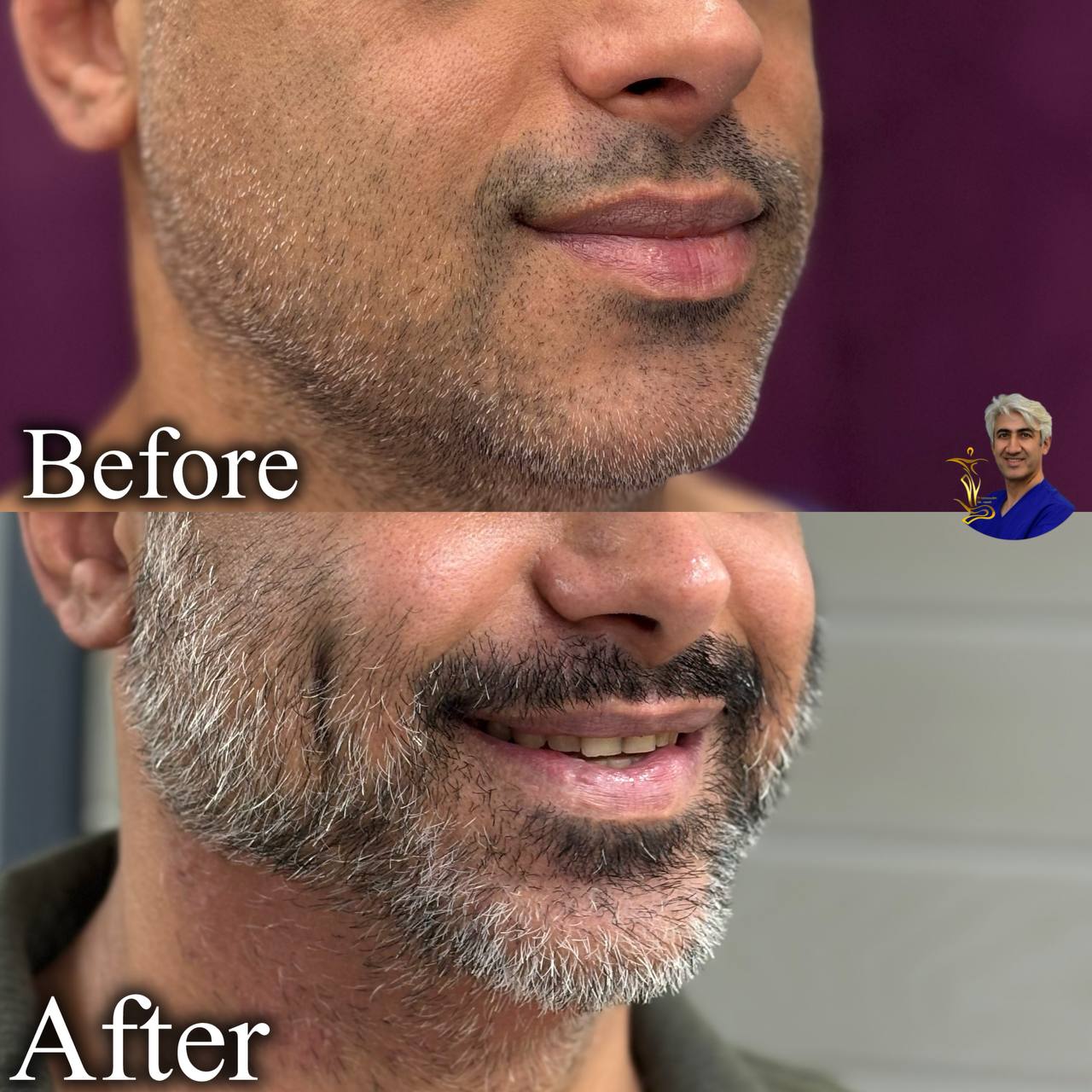 چال گونه